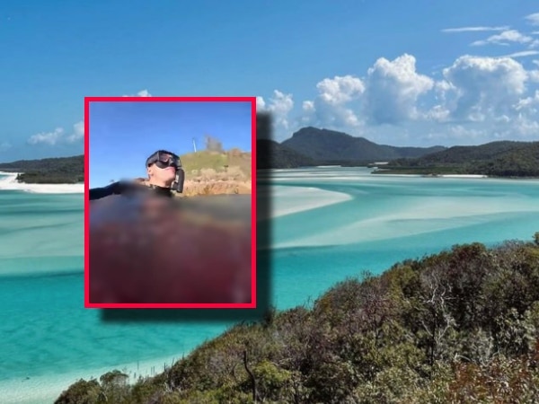 Joven Atacado Por Un Tiburon En Australia.jpg