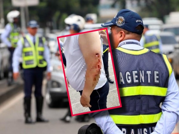 Agente De Transito Lesionado Con Arma Traumatica.jpg